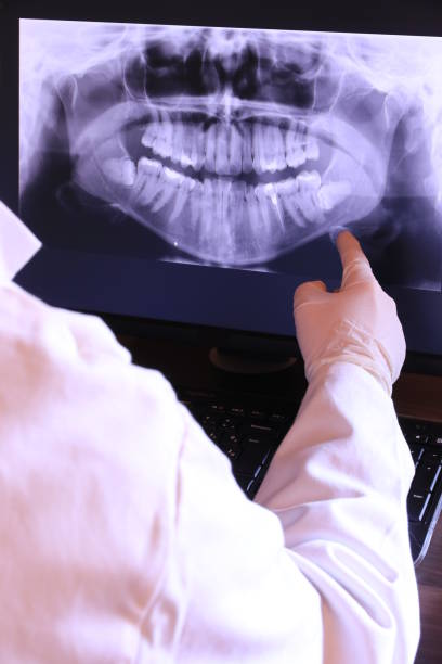 Best Knocked-Out Tooth (Avulsed Tooth) Treatment in Linglestown, PA
